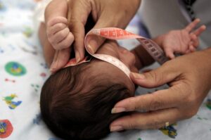 Audiência na Câmara discute cuidados com crianças que nasceram com microcefalia por causa do Zika vírus – Notícias