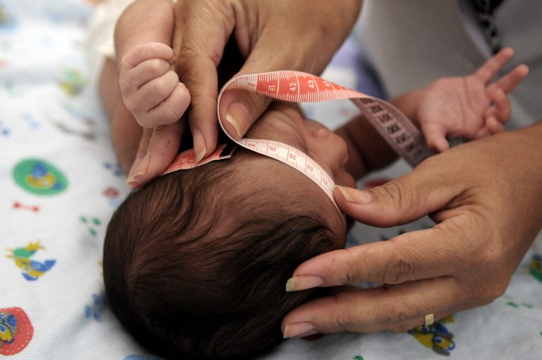 Audiência na Câmara discute cuidados com crianças que nasceram com microcefalia por causa do Zika vírus – Notícias